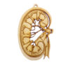 Kidney Ornament | Kidney Transplant Gifts